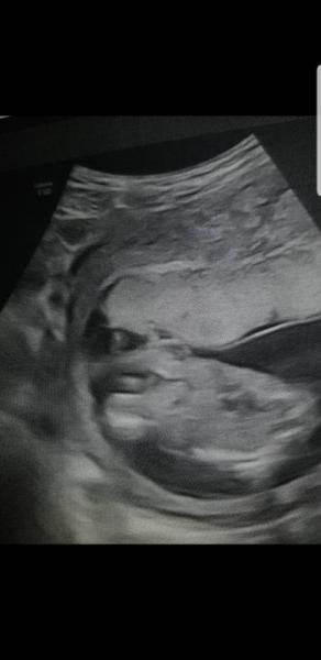 Bild zu Neues Outing - Baby Forum - Allgemeine Themen