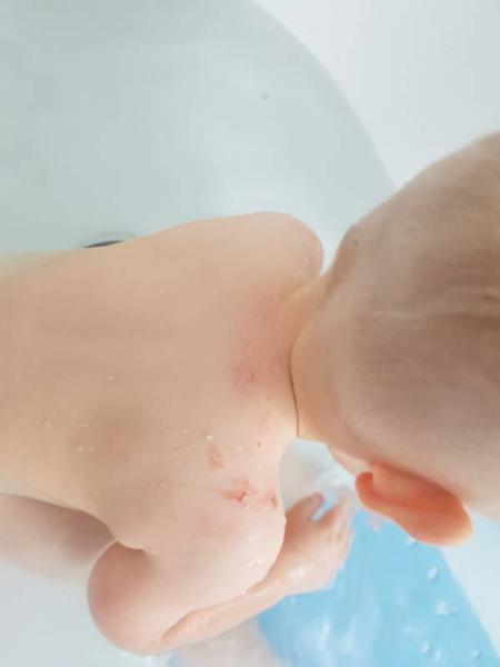 Bild zu Ich brauche nochmal eure Hilfe - Baby Forum - Allgemeine Themen