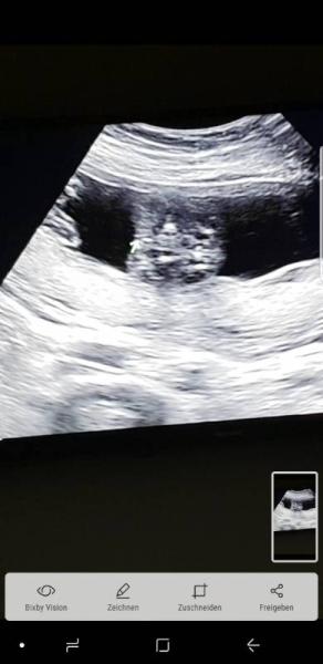 Bild zu Mädchen oder Junge? - Baby Forum - Allgemeine Themen