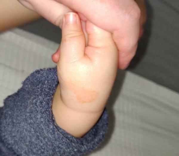 Bild zu Babyhaut. Was könnte das sein? - Baby Forum - Allgemeine Themen