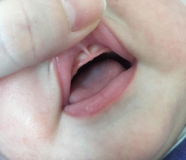 Bild zu Zähne? - Baby Forum - Allgemeine Themen