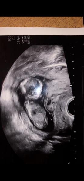 Bild zu Junge oder Mädchen - Baby Forum - Allgemeine Themen
