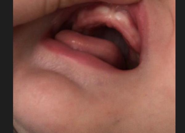 Bild zu Zähne oben kann das sein ? - Baby Forum - Allgemeine Themen