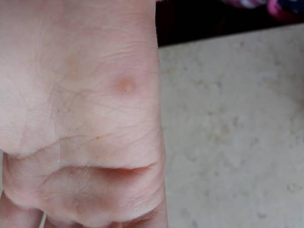 Bild zu Was ist das? - Baby Forum - Allgemeine Themen