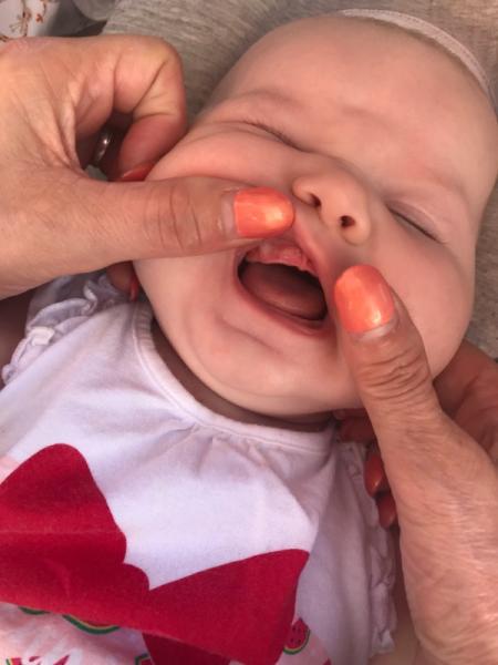 Bild zu Zähne ? - Baby Forum - Allgemeine Themen