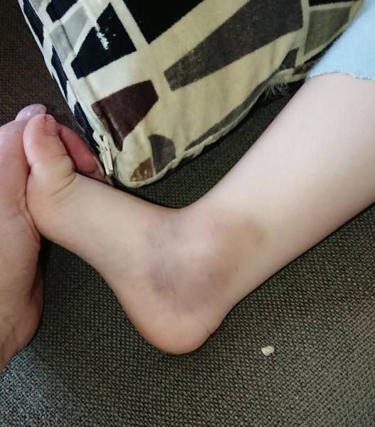 Bild zu Update 2 und Frage - Baby Forum - Allgemeine Themen