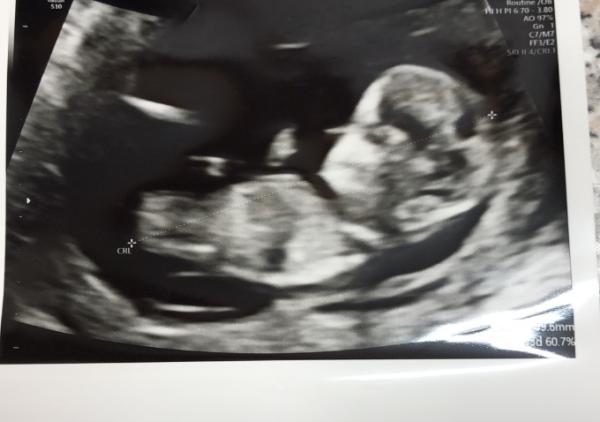 Bild zu Frage - Baby Forum - Allgemeine Themen