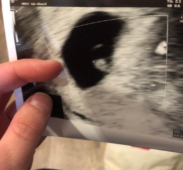 Bild zu Happy - Baby Forum - Allgemeine Themen