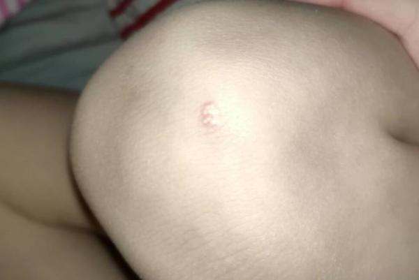 Bild zu Kennt das jemand? - Baby Forum - Allgemeine Themen