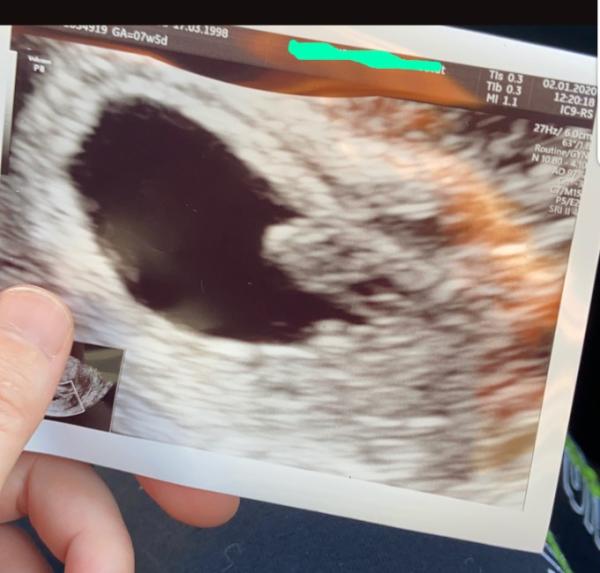 Bild zu Bei wem war das auch so? - Baby Forum - Allgemeine Themen