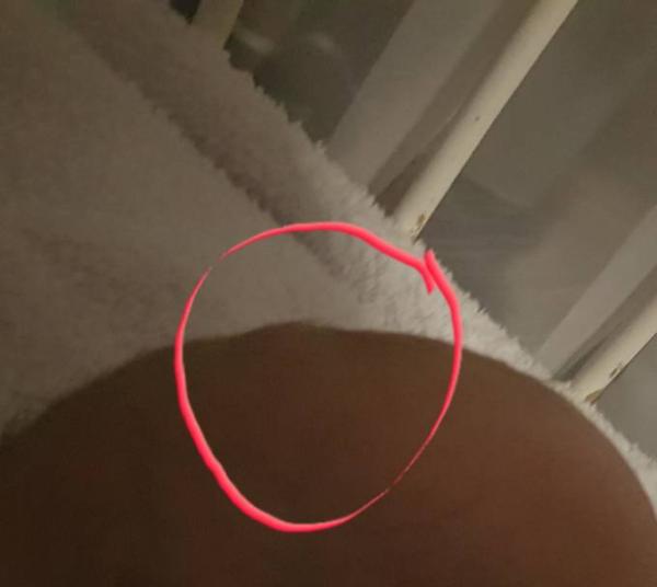 Bild zu Fontanelle erhöht. - Baby Forum - Allgemeine Themen
