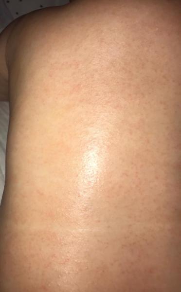 Bild zu Hautproblem Baby Hilfe 😒 - Baby Forum - Allgemeine Themen