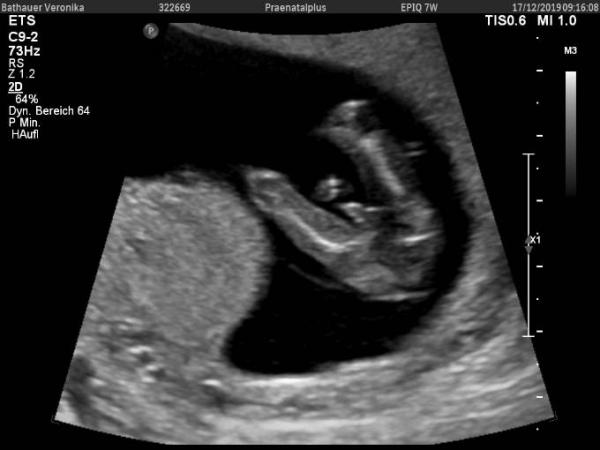 Bild zu Junge oder Mädchen? - Baby Forum - Allgemeine Themen