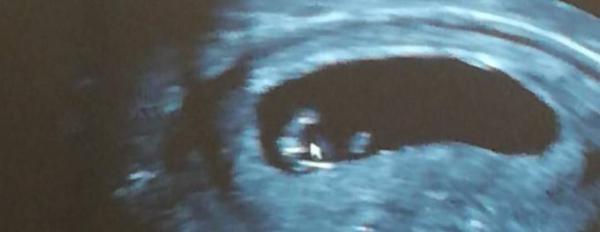 Bild zu Geschlechts Outing - Baby Forum - Allgemeine Themen