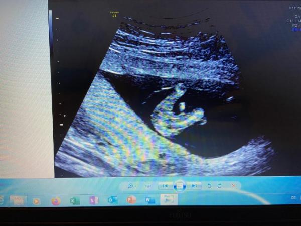 Bild zu Auch hier spiele ich gleich mit Offenen Karten. - Baby Forum - Allgemeine Themen