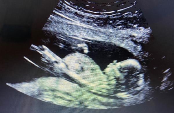 Bild zu Ab welche Woche - Baby Forum - Allgemeine Themen