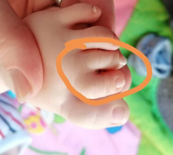 Bild zu Komische zehen - Baby Forum - Allgemeine Themen