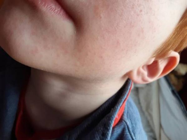 Bild zu Glaskugel Schwarmwissen - Baby Forum - Allgemeine Themen