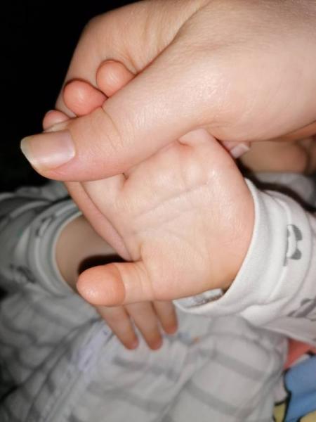 Bild zu Vierfingerfurche - Baby Forum - Allgemeine Themen