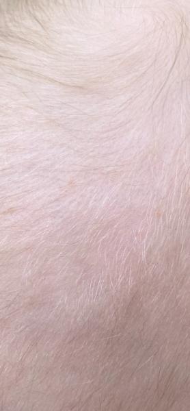 Bild zu Was könnte das sein ? - Baby Forum - Allgemeine Themen
