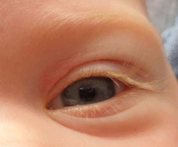 Bild zu Auge Baby - Baby Forum - Allgemeine Themen