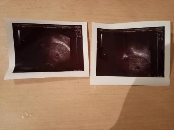 Bild zu Wichtig !! - Baby Forum - Allgemeine Themen