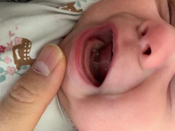 Bild zu Eppstein Perlen oder pilz? - Baby Forum - Allgemeine Themen