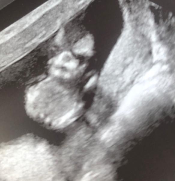 Bild zu Junge oder Mädchen ?:) - Baby Forum - Allgemeine Themen
