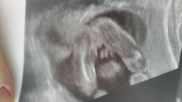 Bild zu Falsches Outing??? - Baby Forum - Allgemeine Themen