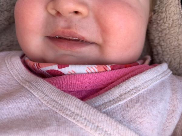 Bild zu Pickelchen oder wird das Herpes? - Baby Forum - Allgemeine Themen