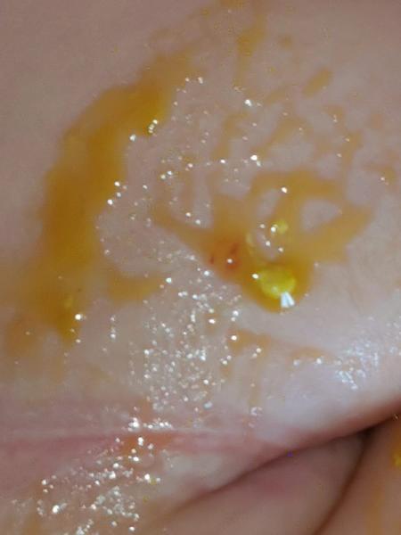 Bild zu Ganz bisschen blut im Stuhlgang - Baby Forum - Allgemeine Themen