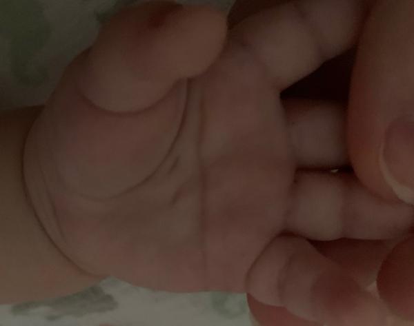 Bild zu Ist das normal? - Baby Forum - Allgemeine Themen
