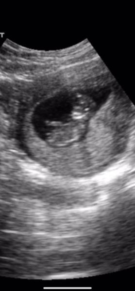 Bild zu Nub und Skull Theorie - Baby Forum - Allgemeine Themen