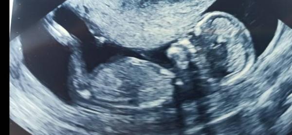 Bild zu Geschlecht Baby - Baby Forum - Allgemeine Themen