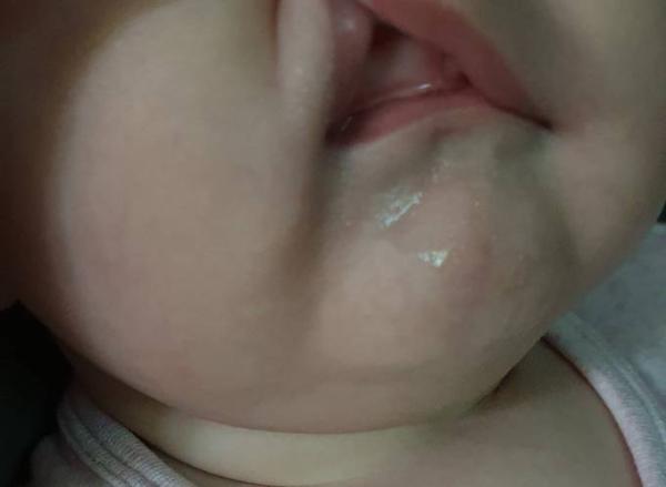 Bild zu Zahnen? - Baby Forum - Allgemeine Themen