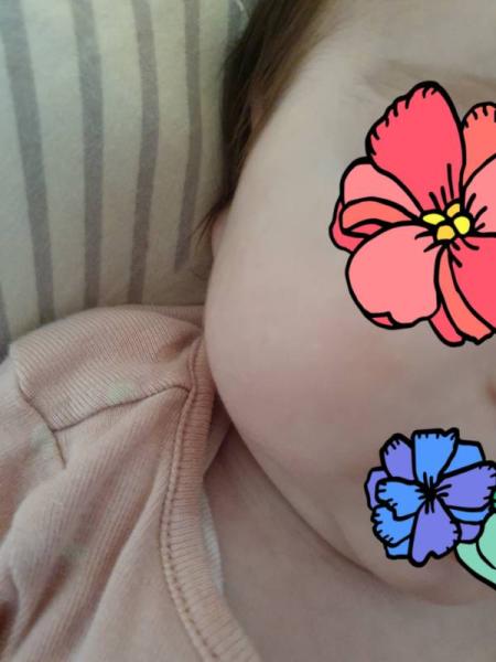 Bild zu Helle Haut - Baby Forum - Allgemeine Themen