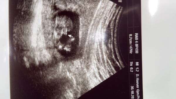 Bild zu Ist das eindeutig ein Junge? - Baby Forum - Allgemeine Themen