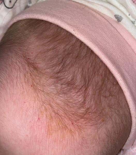 Bild zu Kennt ihr sowas? - Baby Forum - Allgemeine Themen