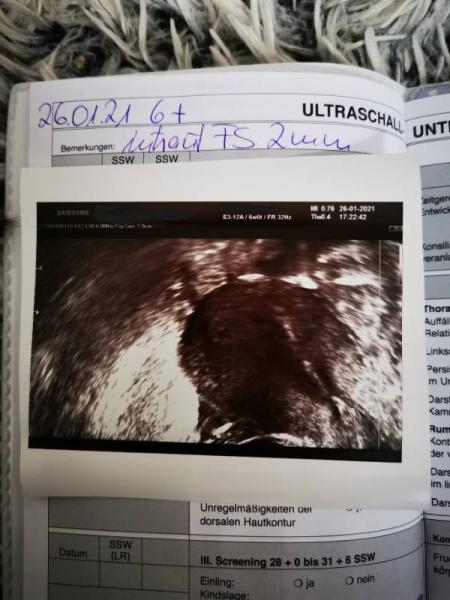 Bild zu Kann mir bitte jemand das Bild erklären? - Baby Forum - Allgemeine Themen