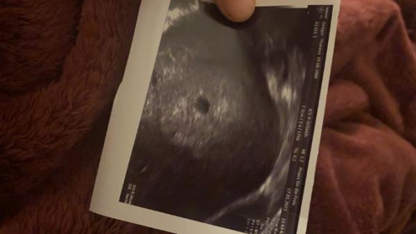 Bild zu 5 SSW - Baby Forum - Allgemeine Themen