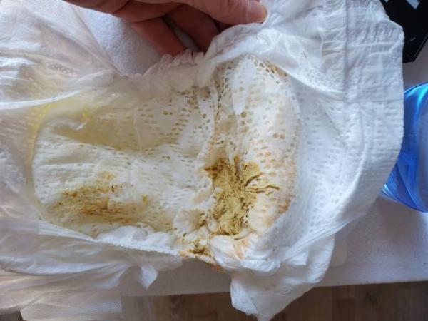 Bild zu Vorsicht Windelbild!nur bei Pampers rötlicher SG - Baby Forum - Allgemeine Themen