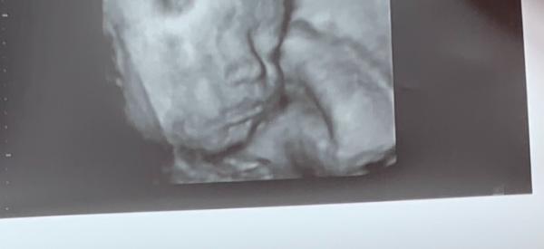 Bild zu Mai babys - Baby Forum - Allgemeine Themen