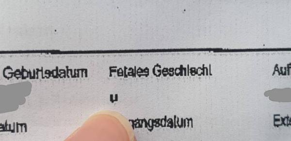 Bild zu Mädchen oder Junge :) - Baby Forum - Allgemeine Themen