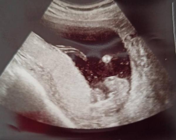 Bild zu Jungenouting - Baby Forum - Allgemeine Themen