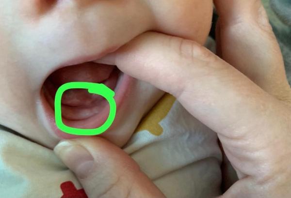 Bild zu Zähne?! :) - Baby Forum - Allgemeine Themen