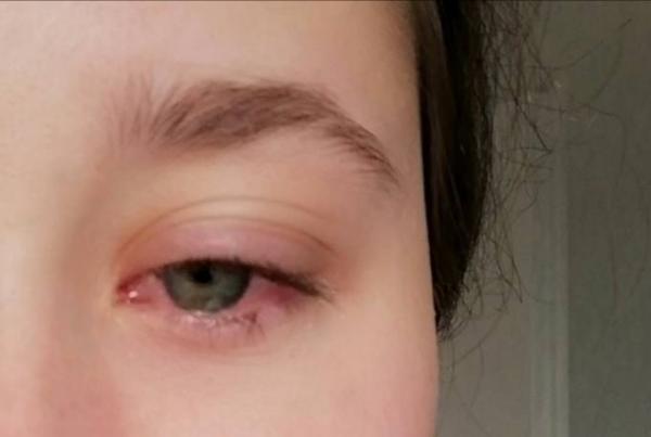 Bild zu Augen Update - Baby Forum - Allgemeine Themen