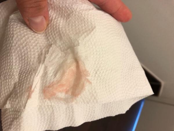 Bild zu ES + 11 hellrote Blutung , Zyklus abgehakt oder noch Chancen ? - Baby Forum - Allgemeine Themen