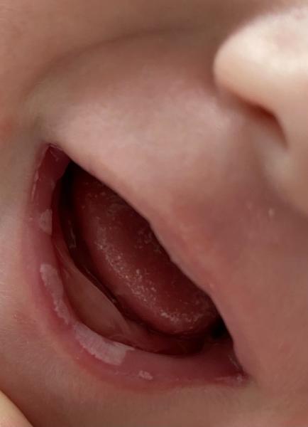 Bild zu Wonach sieht das für euch aus? - Baby Forum - Allgemeine Themen
