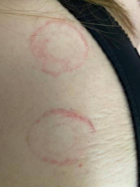 Bild zu Was könnte das sein? - Baby Forum - Allgemeine Themen
