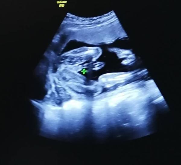 Bild zu Hilfe beim Geschlecht?! - Baby Forum - Allgemeine Themen